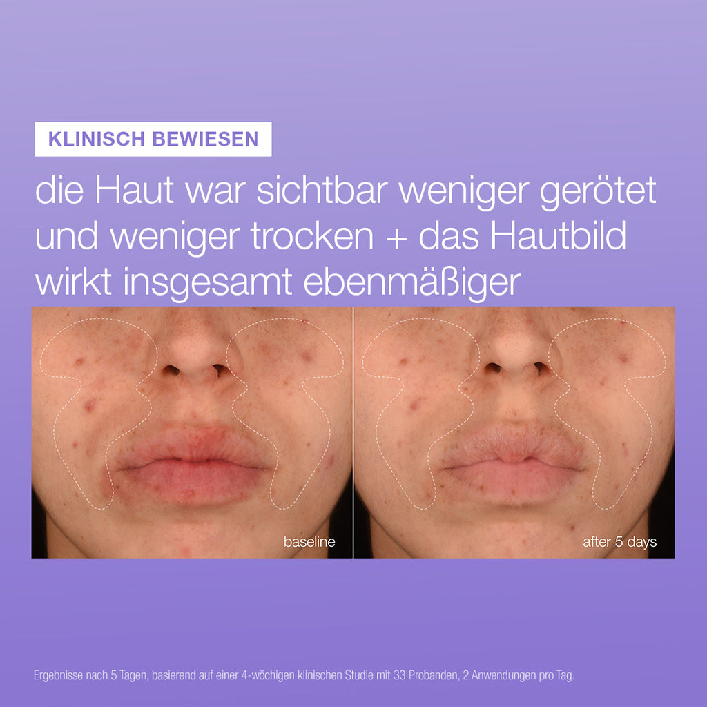 Stabilizing Repair Serum 3er Deal