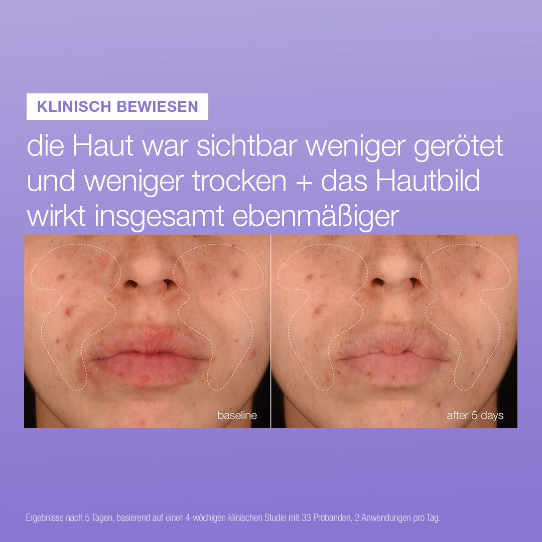Stabilizing Repair Serum 3er Deal