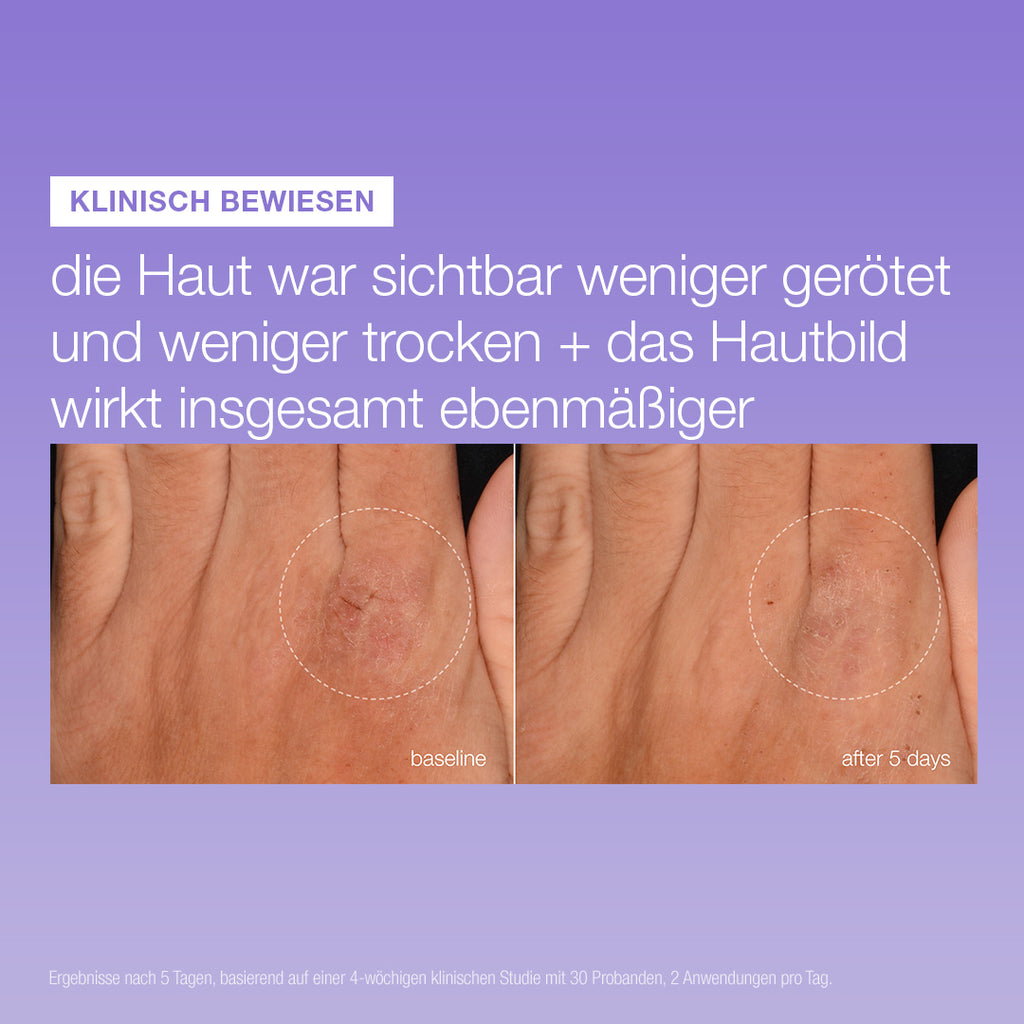 Stabilizing Repair Serum 3er Deal