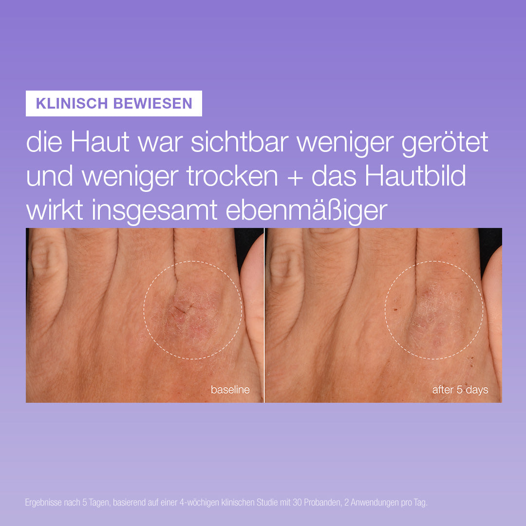 Stabilizing Repair Serum 3er Deal