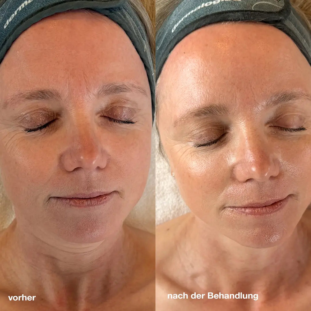 Longevity Glow Treatment